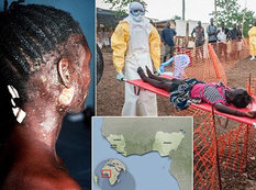 Qərbi Afrikada &quot;Ebola&quot; virusundan ölənlərin sayı mini keçdi
