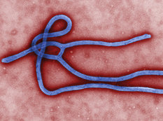 SOS: Ebola virusu Azərbaycana yaxınlaşır