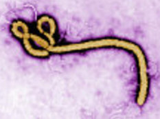Ebola-nın yayılma riskinin yüksək olduğu ölkələrin siyahısı açıqlandı
